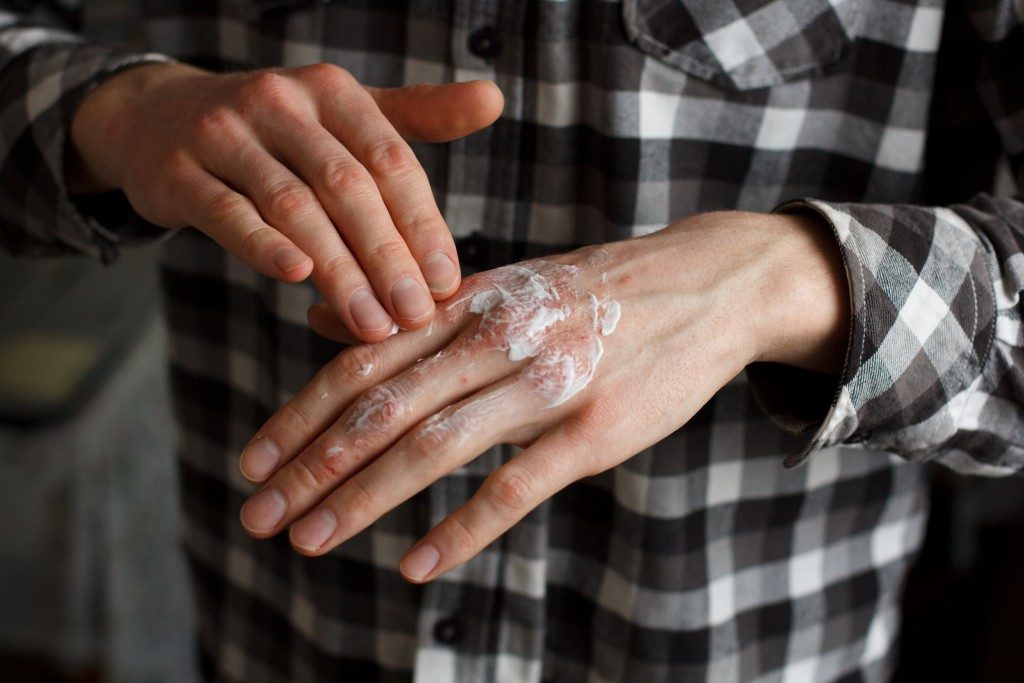 Man applying cream on his hands