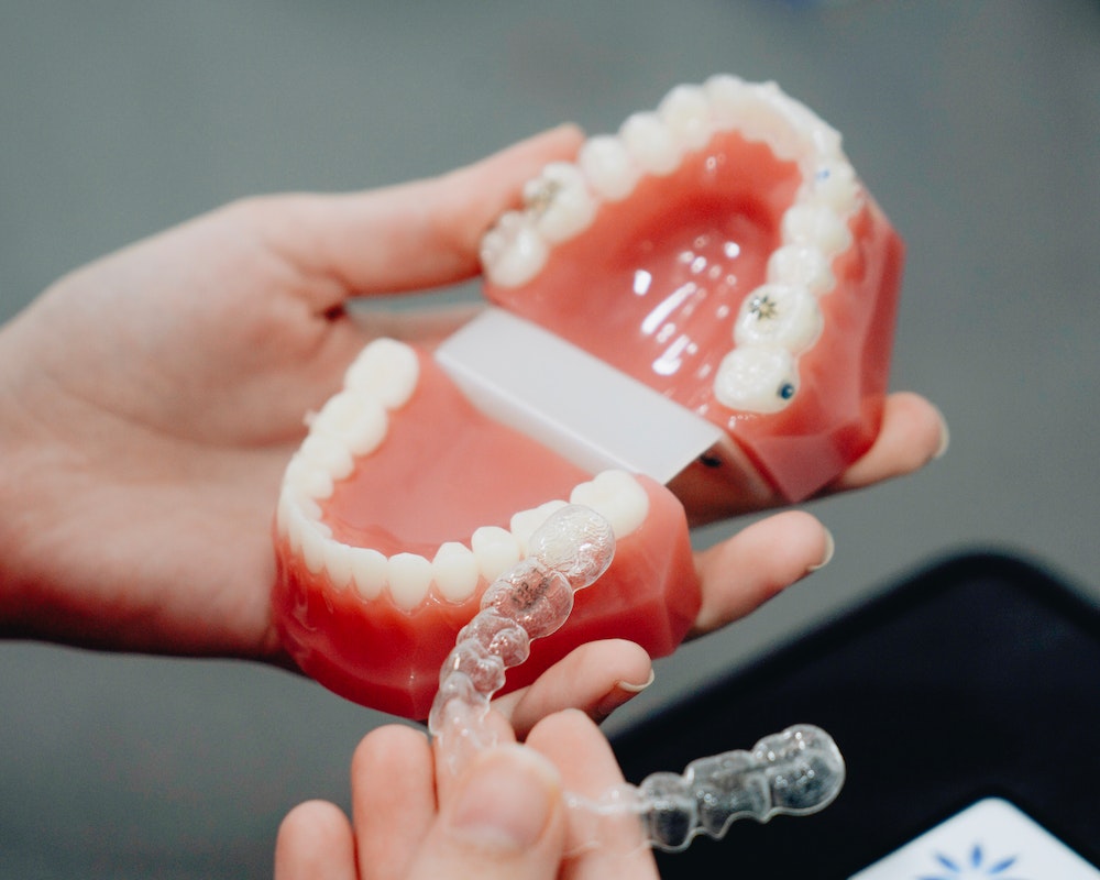 ands of a Person Holding Clear Retainers and Teeth Mould